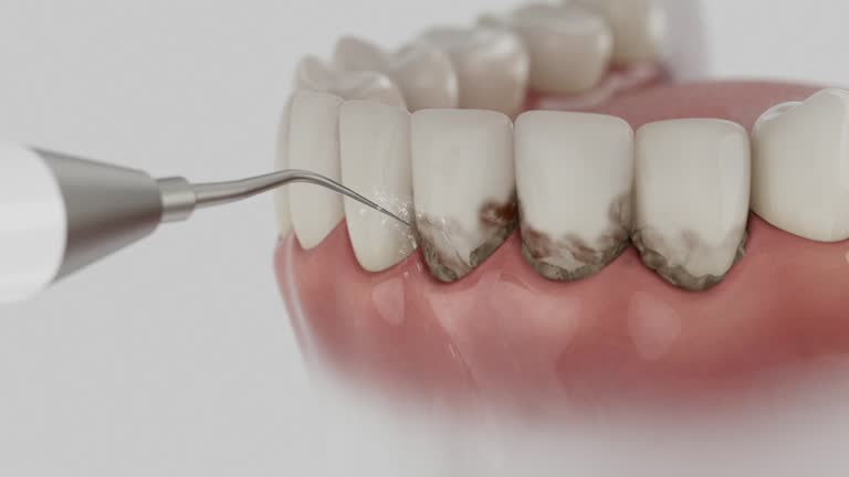 Trusted Teeth Cleaning And Checkup service in Bothell West, WA - Dentist Open Now